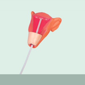 Who is the intrauterine device suitable for?