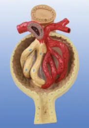 How can the glomerular model become a key part of precision medicine