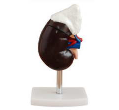 Liver anatomical model is an important assistant in clinical medicine