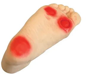 Can advanced diabetic foot care Model effectively reduce amputation rate?
