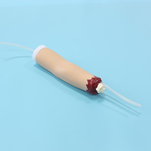 The success criteria of the hemostasis model for upper limb trauma amputation