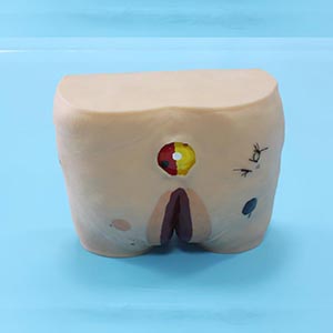 Medical Care Model